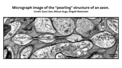 Micrograph image of the "pearling" structure of an axon (mouse brain). Credit: Quan Gan, Mitsuo Suga, Shigeki Watanabe